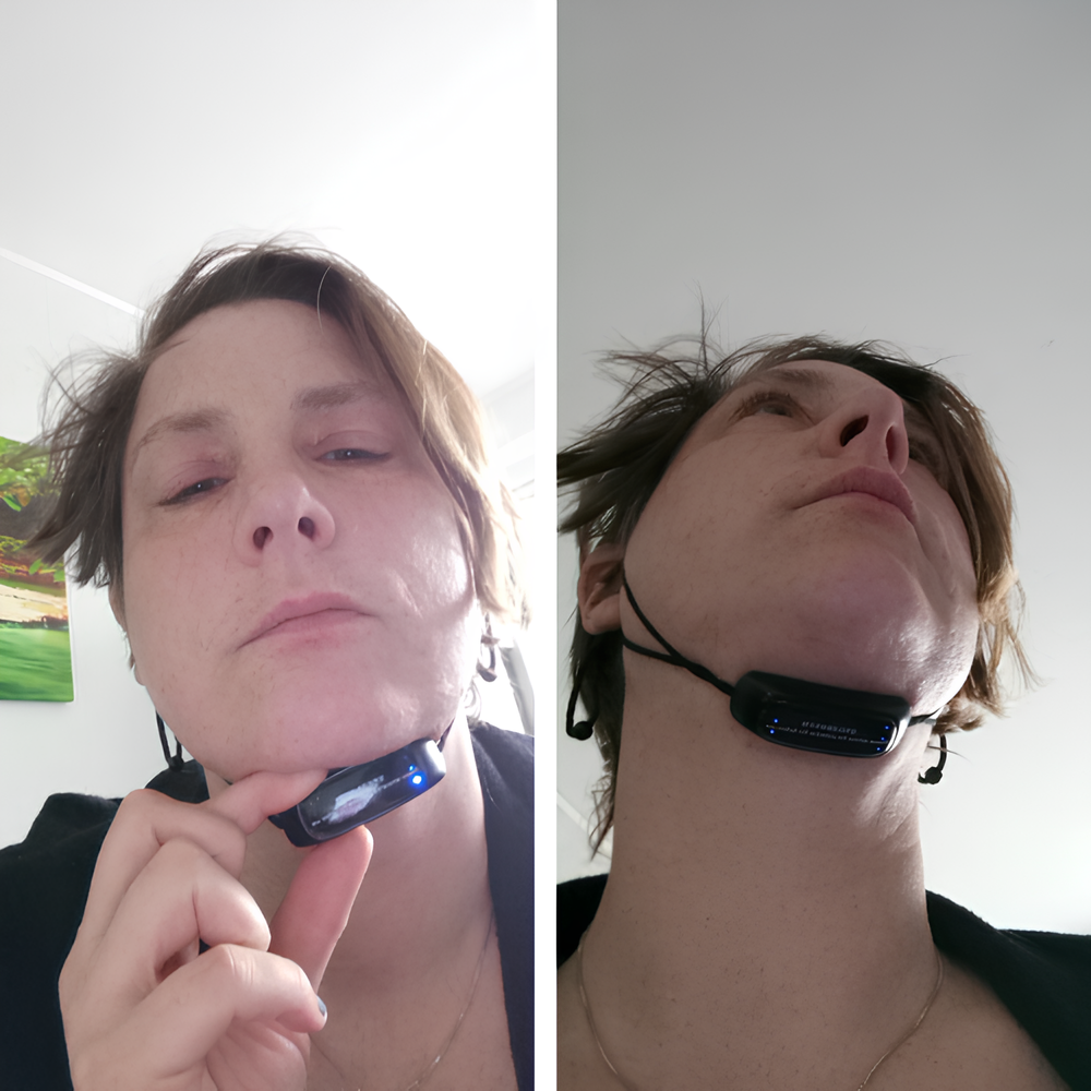 FaceLift™ – Anti-Wrinkle & Double Chin Sculpting Device + FREE Aloe Vera Gel