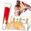 Anti-inflammatory Bunion Cream