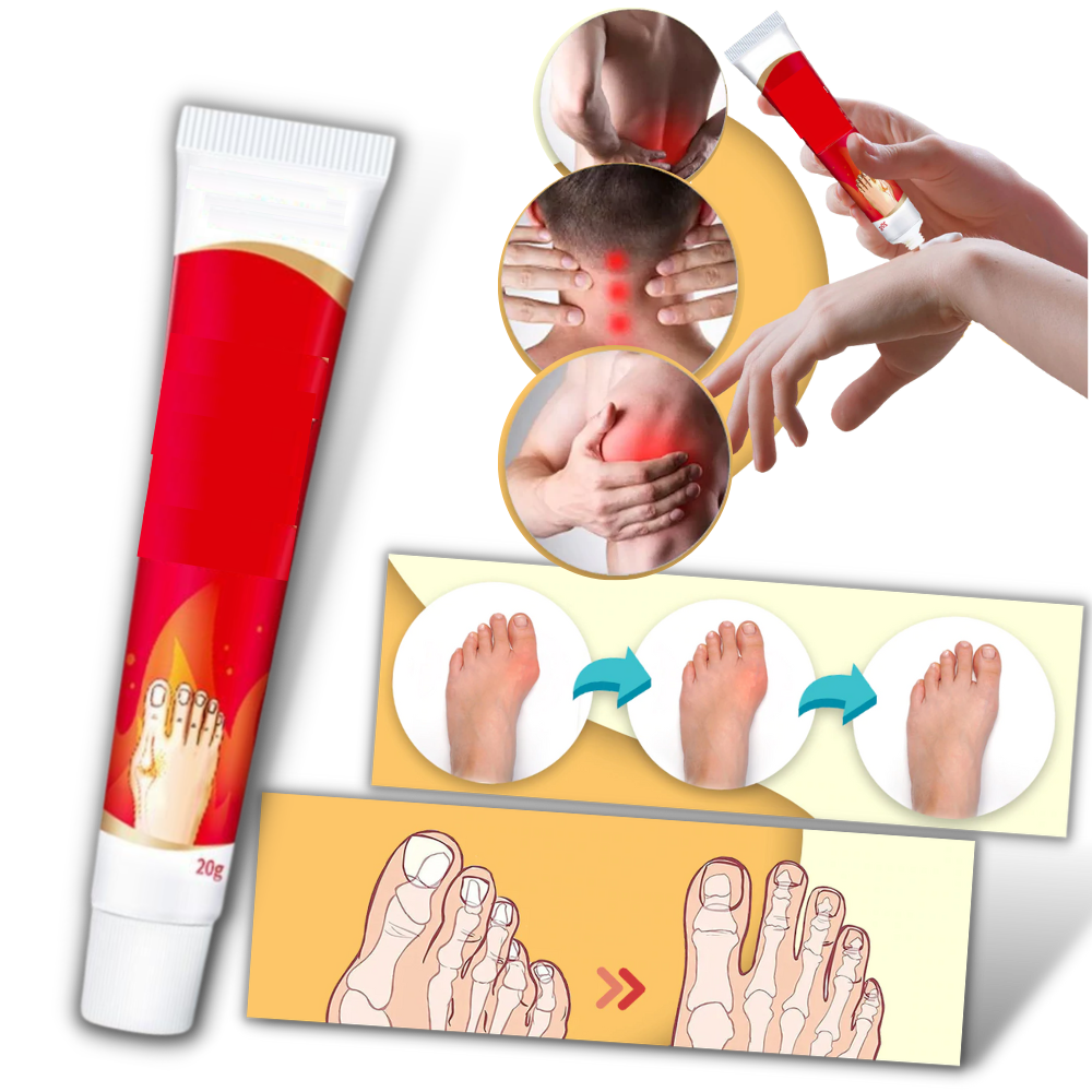 Anti-inflammatory Bunion Cream