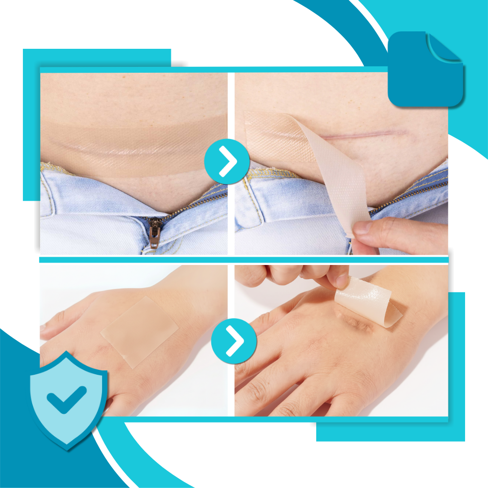 Hyaluronic Silicone Scar Patch
