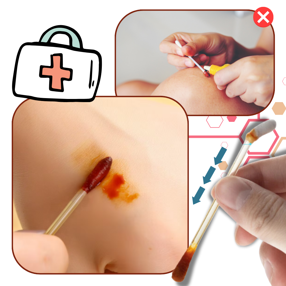 Iodine Swabsticks
