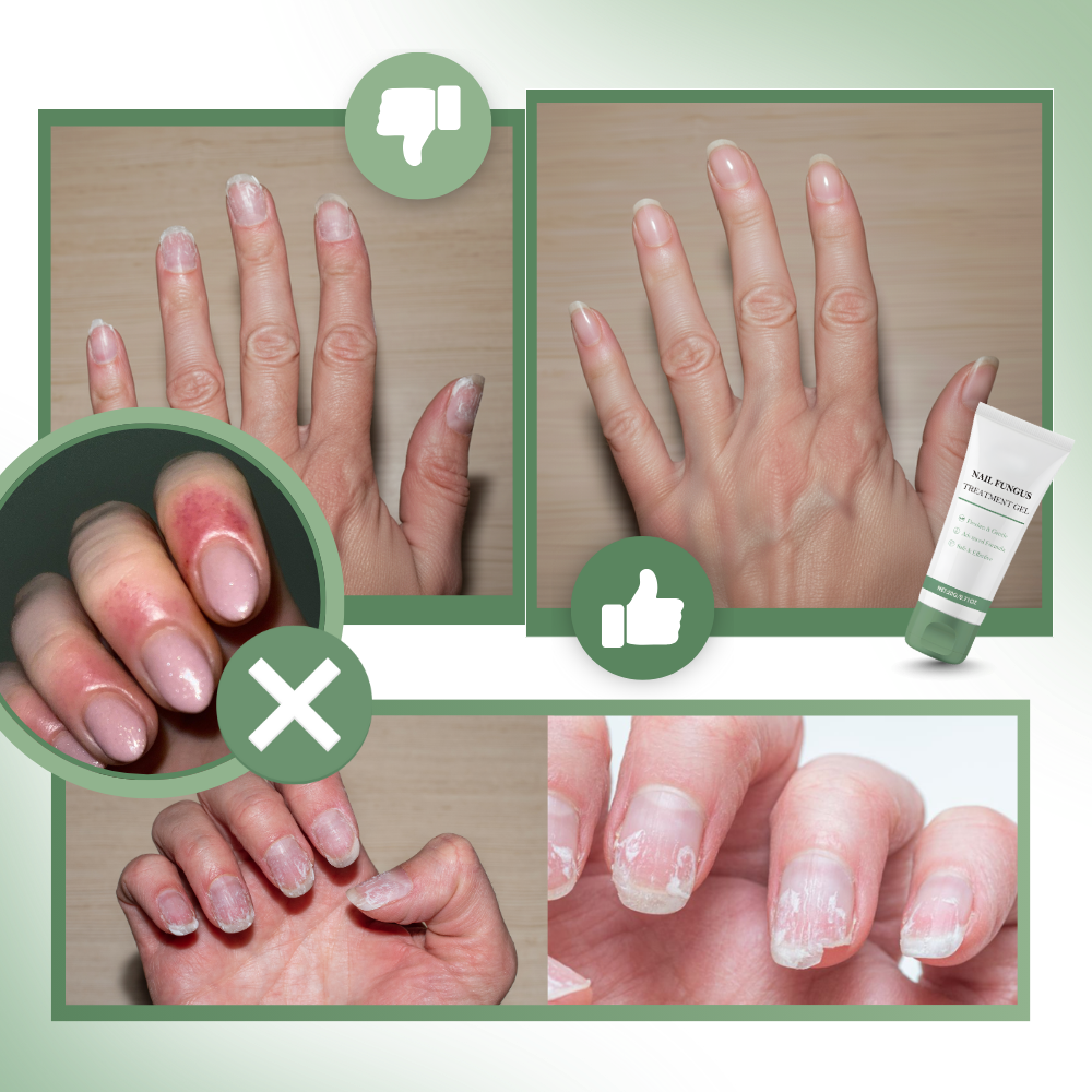 Nail Revitalizing & Moisturizing Gel