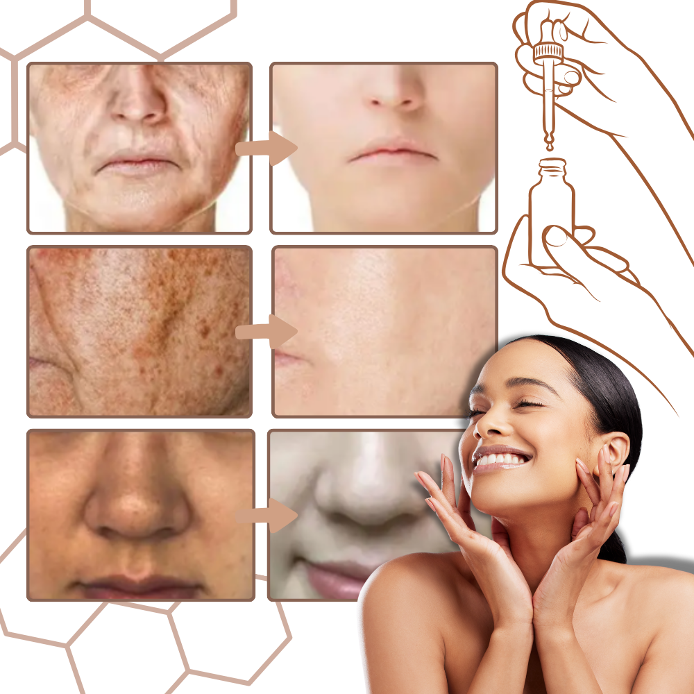 Non-Greasy Melanin Correcting Facial Serum