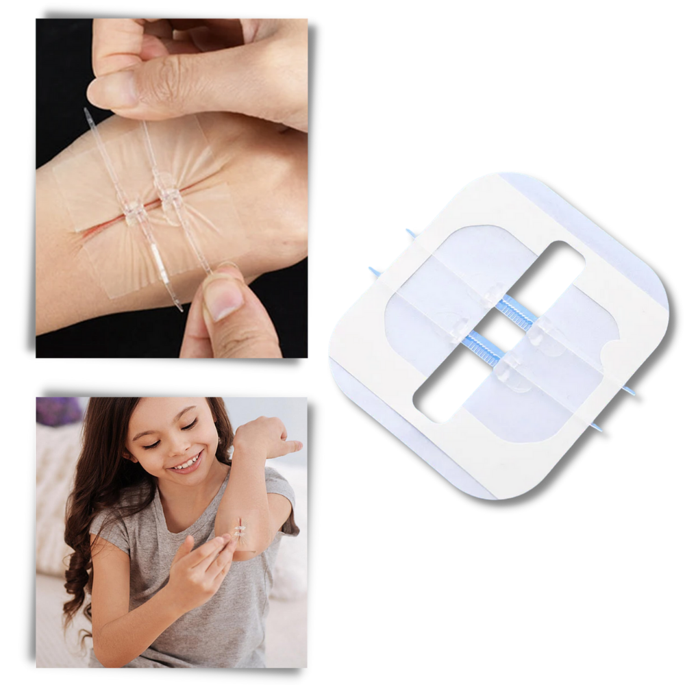 Water-proof wound adhesive