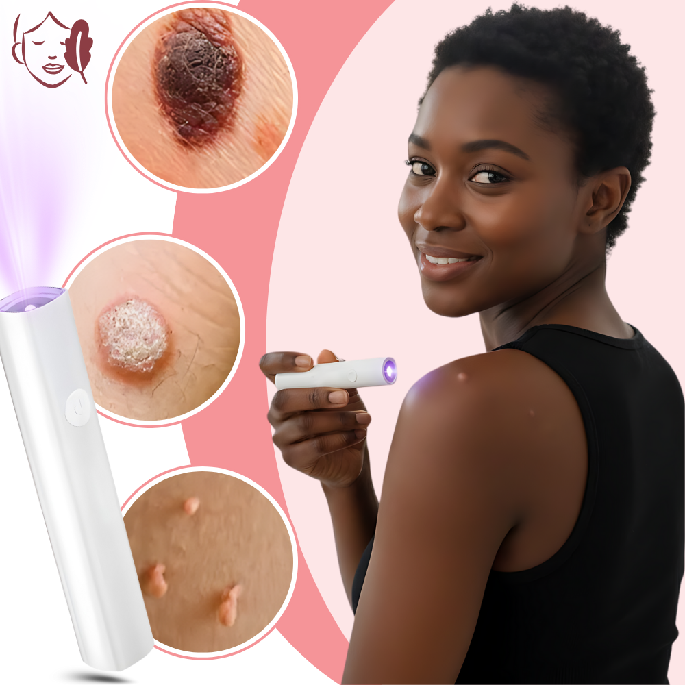Radiance Cosmetic Laser Pen