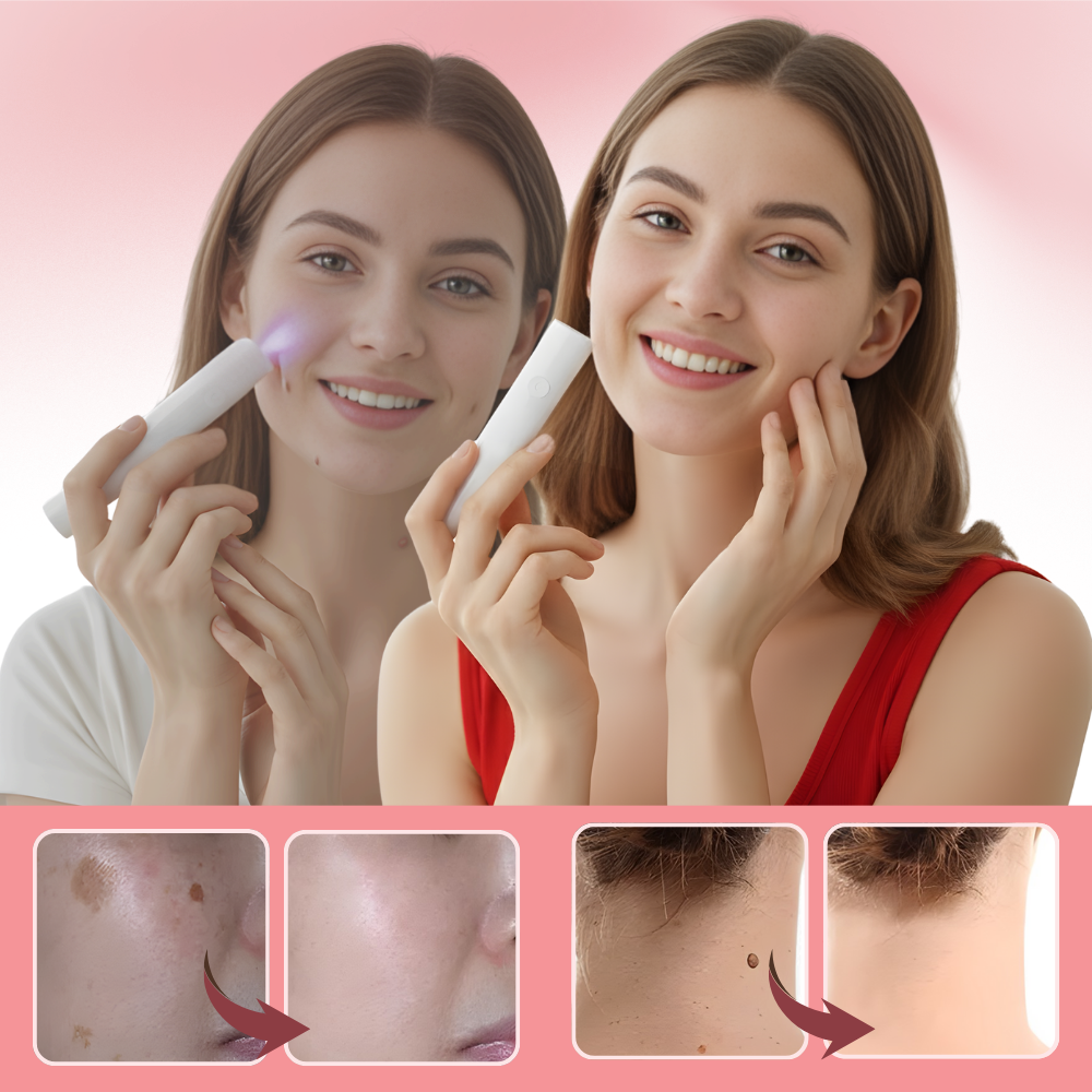 Radiance Cosmetic Laser Pen