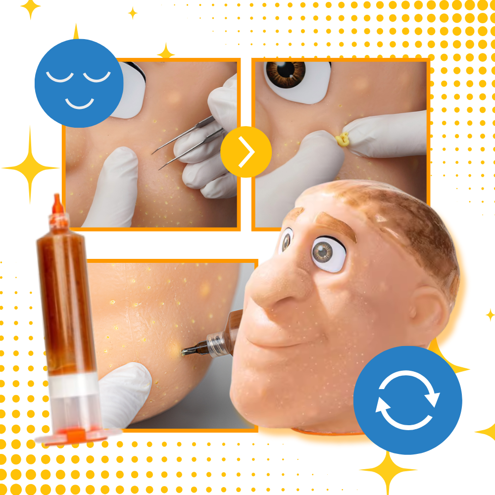 Relaxing Silicone Pimple Pop Toy