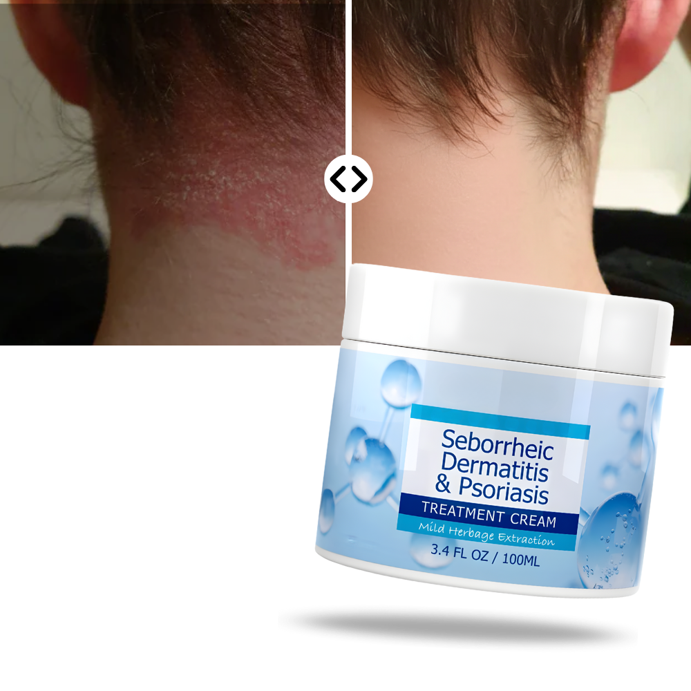Scalp Care Hydrating Cream
