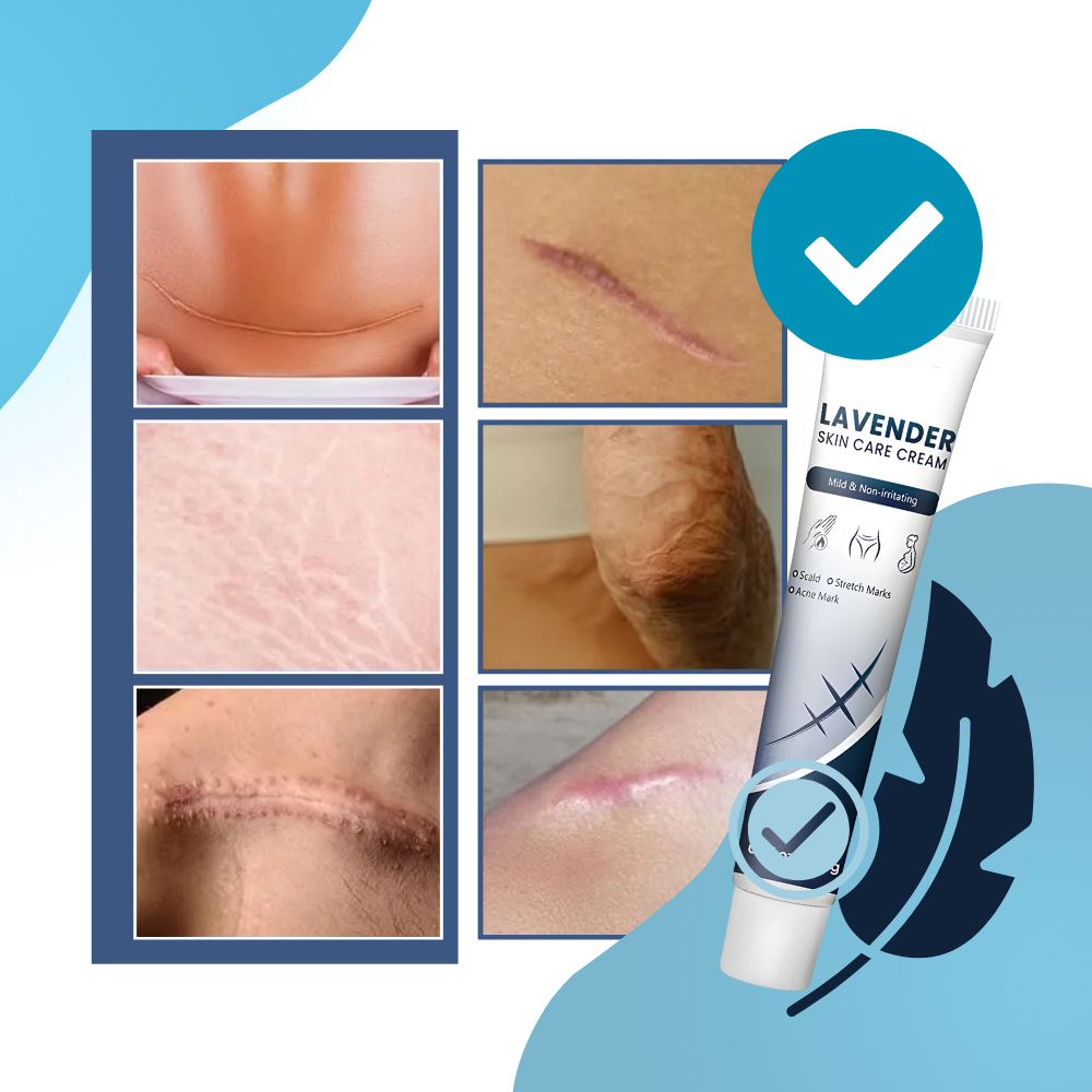 Scar Hydrating Silicone Cream