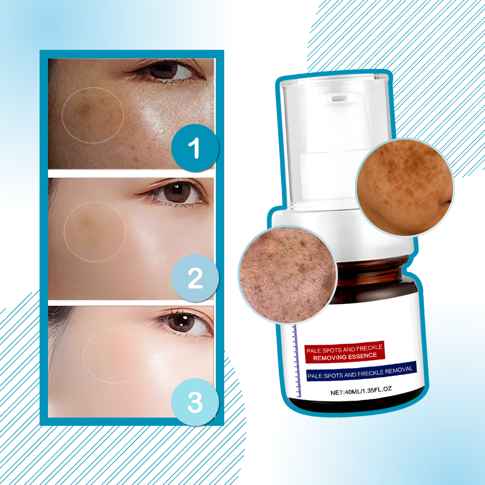 Skin Brightening Silky Kojic Serum
