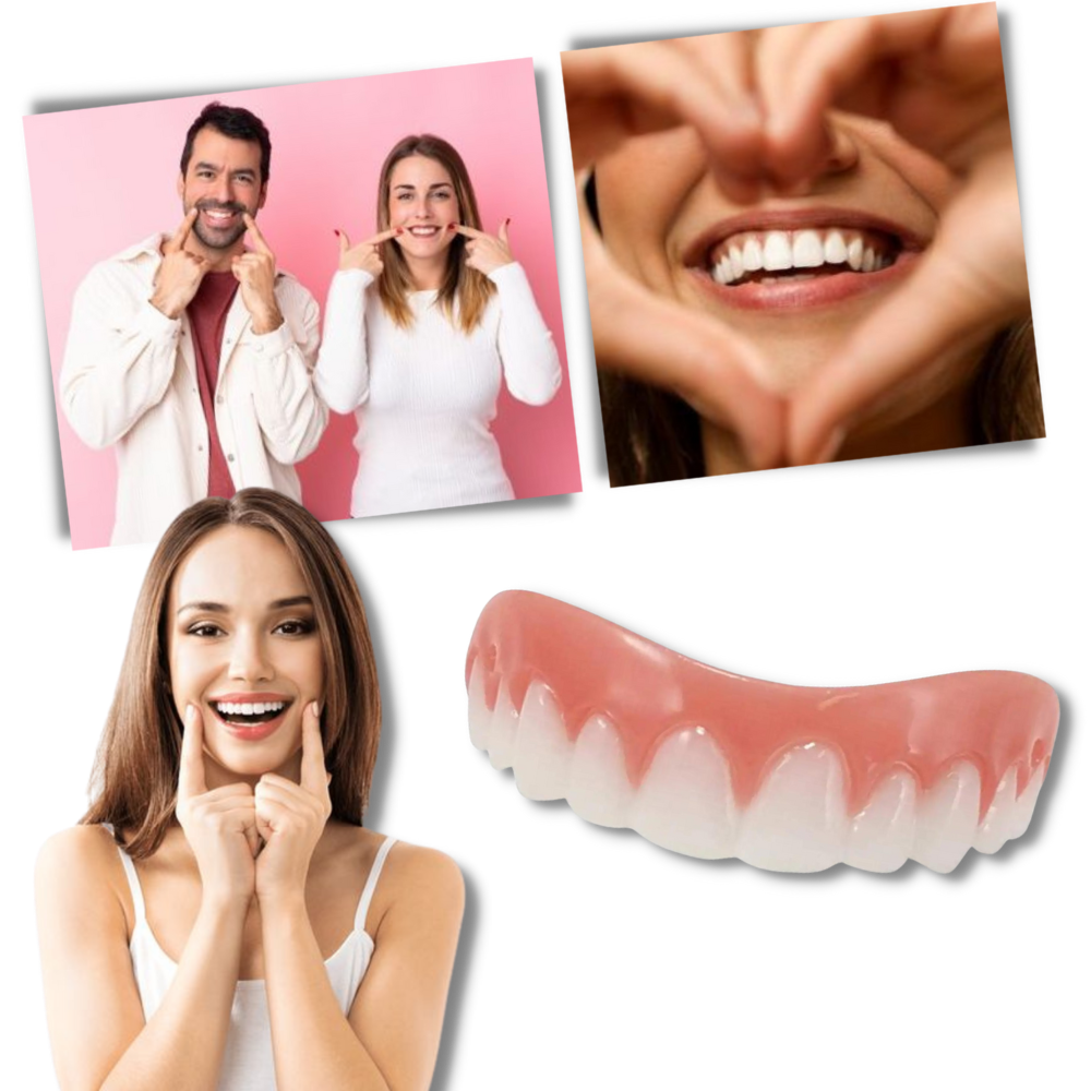 Snap-On Veneer Teeth