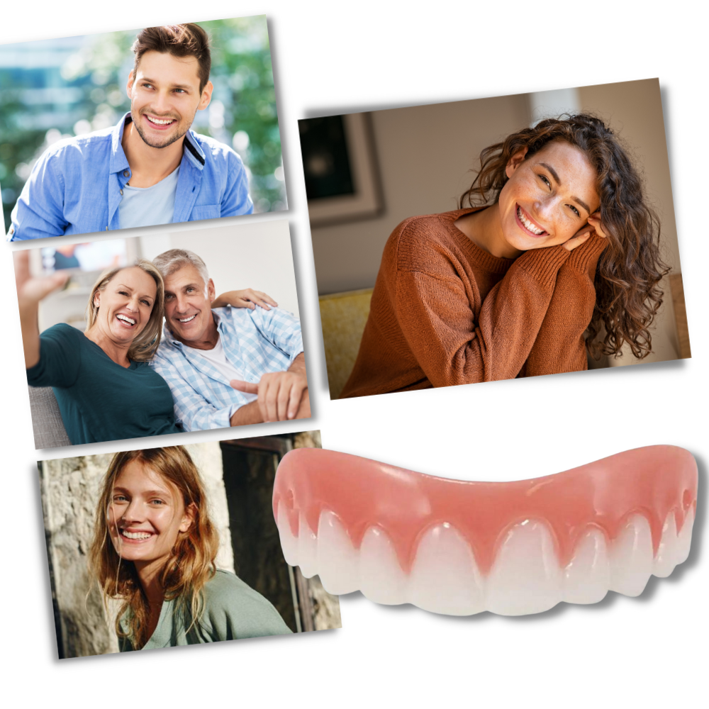 Snap-On Veneer Teeth