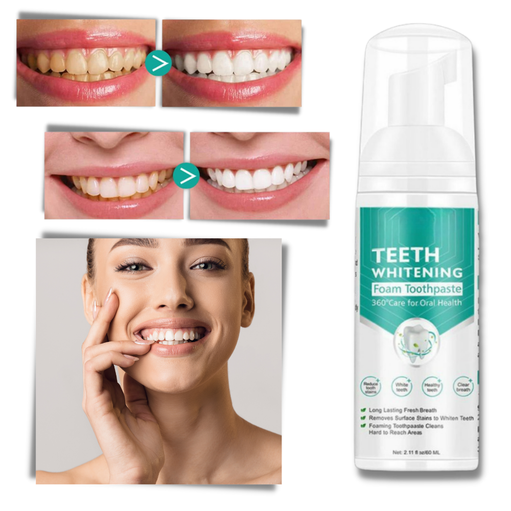 Teeth Whitening Foam